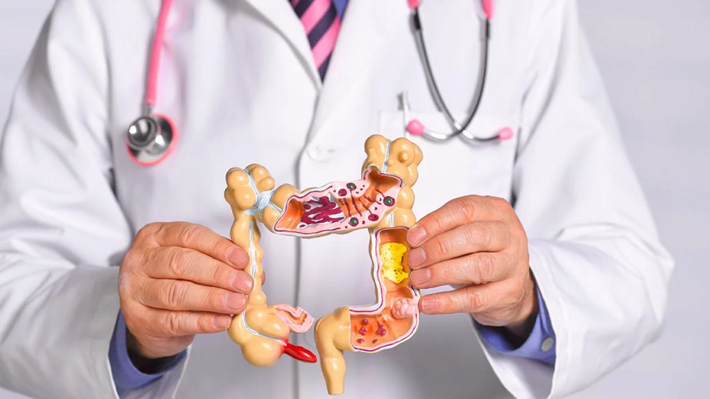 Clinical discovery enormously improves colorectal most cancers remedy 3