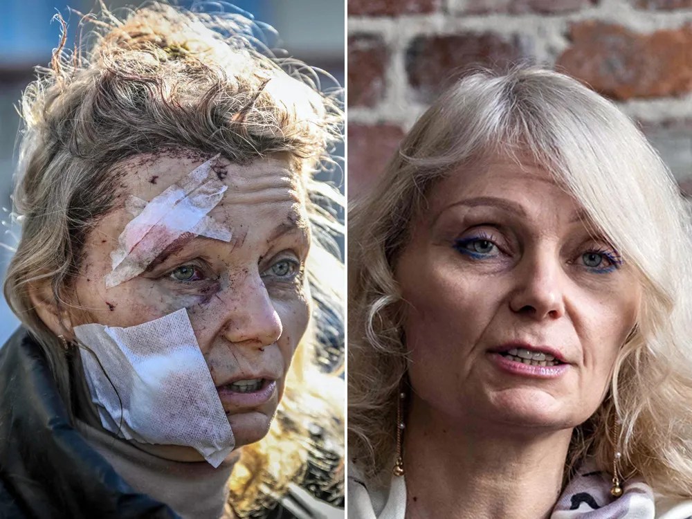 Ukrainian woman in iconic war photos remembers deadly Russian attack 16