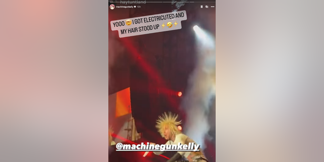 Device Gun Kelly claims he used to be ‘electrocuted’ on level at Tremendous Bowl birthday celebration: ‘My hair stood on end’ 3