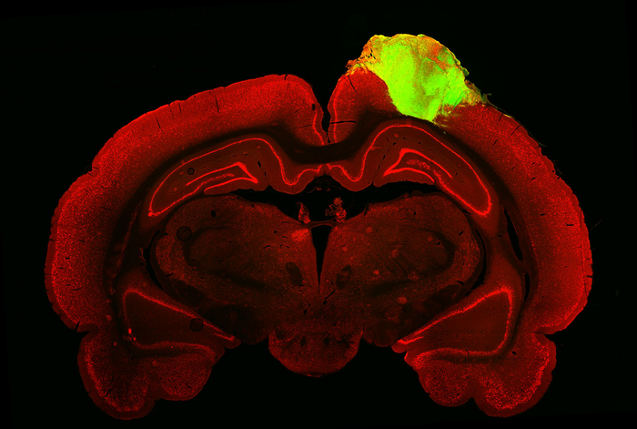 "Breakthrough Study Finds Human Brain Clumps Transplanted into Rat Brains React to Light and Sound" 23