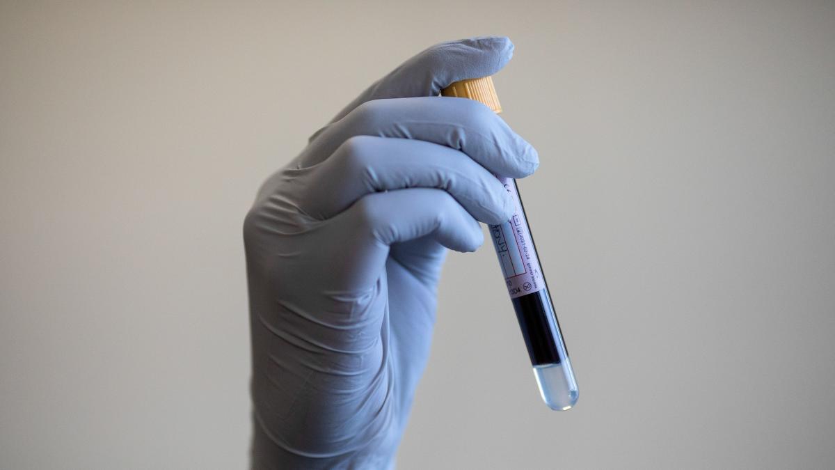 New blood test for prostate cancer is 94% accurate, researchers say 3