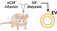 Exosomes Reveal Sex Differences in Alzheimer's Progression