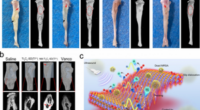 2D Nano-Sheets Combat Bone Infection.