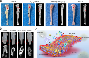 2D Nano-Sheets Combat Bone Infection.