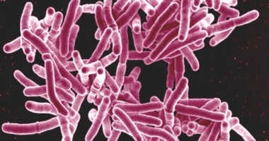 India's Challenge to Eliminate TB
