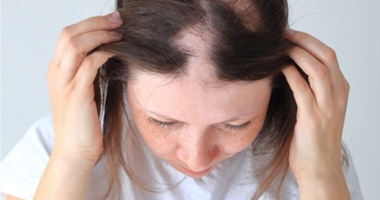 Transforming Alopecia Assessment with Technology.