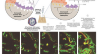 Polymeric Gene Therapy for Bone Healing