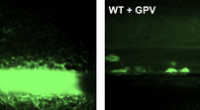 Discovering a new way of blood clotting.