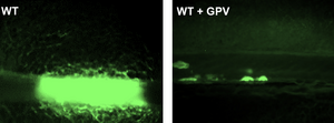 Discovering a new way of blood clotting.