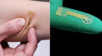 Smart Bandage: Faster Wound Healing
