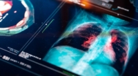 Transforming Lung Research for Better Health