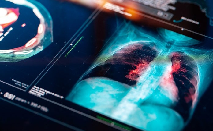 Transforming Lung Research for Better Health