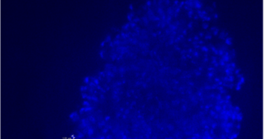 Temperature Adaptation in Methanogens