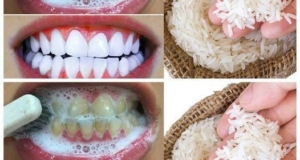 Whiten Your Teeth in Just 1 Minute: A Quick and Natural Solution 16